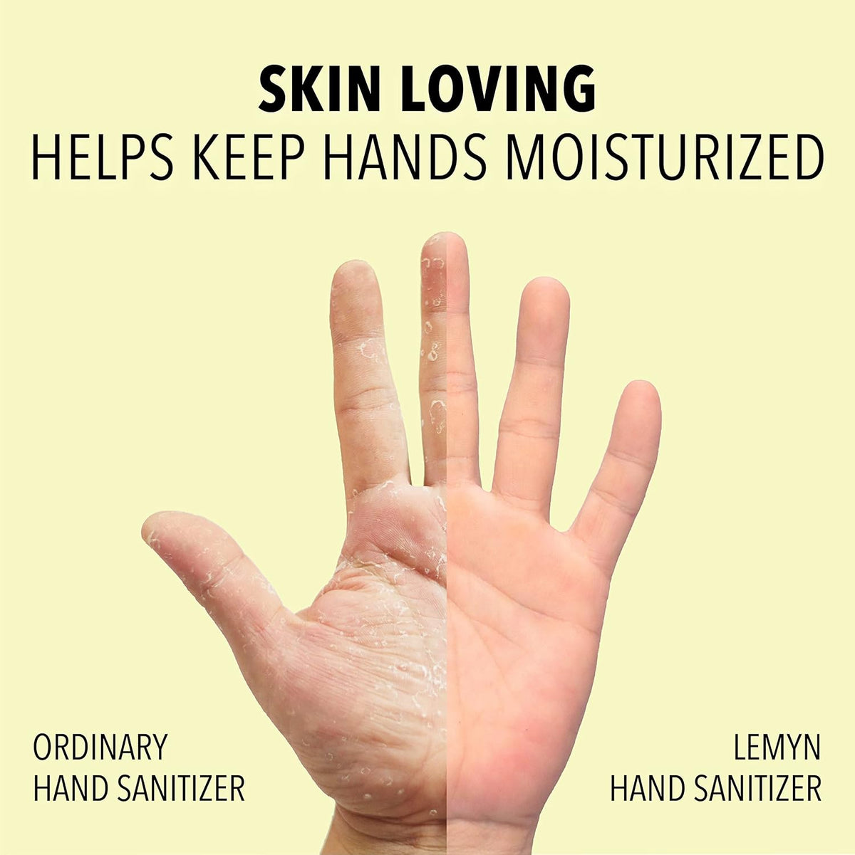 Skin loving - Lemyn hand sanitizer keeps hands moisturized compared with ordinary hand sanitizer